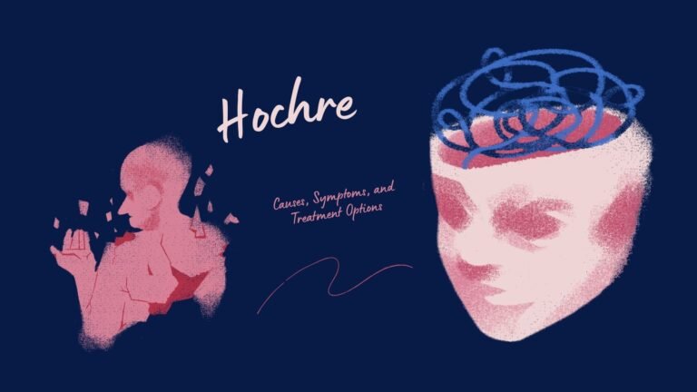 Hochre Explained: What You Need to Know
